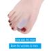 Toe Spacers 8 Pack - Bunion Corrector & Toe Separator for Overlapping Toes - Men & Women - Buy Online on GoSupps.com