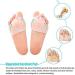 Akozon Gel Toe Separator - Soft Silicone Hallux Valgus Correction Set | Pain Relief for Hammer Toe & Bunion | 2 Pairs - Yoga & Sport Recovery - Buy Online on GoSupps.com