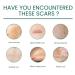 ScarRevita Advanced Repair Serum - Suitable for All Skin Types | Advanced Scar Gel for Skin Repair - 1pcs - Buy Online on GoSupps.com