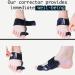 Cubaco Articulated Bunion Corrector & Separator - Black | Relieve Pain & Improve Alignment - Buy Online on GoSupps.com