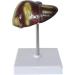 Liver Anatomy Model Human Liver Disease Model Liver Fat/Cirrhosis/Pathological Hepatobiliary Disease Model Medical Education and Training Auxiliary Human Organ Anatomical Model - Buy Online on GoSupps.com