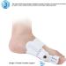 Bunion Corrector for Women and Men - Orthopedic Black, Ideal for Hallux Valgus, Bent Toes, and Pain Relief - Buy Online on GoSupps.com