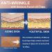 Akissos Facial Myofascial Lift Tape - Face & Neck Firming Belts, Anti Wrinkle Patches - 1 Roll - Buy Online on GoSupps.com