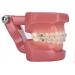 Dytah 1:1 Orthodontic Treatment Teeth Model - Patient Communication & Teaching Tool with Metal & Ceramic Brackets for Adults - Buy Online on GoSupps.com