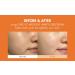 Dr.Ceuracle Pure Vitamin C Mellight Cream | Tone-Up Serum for Face | Anti-Aging Moisturizer | Brighten Dark Spots & Wrinkles | Paraben-Free | Shop Internationally - Buy Online on GoSupps.com