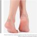FOMIYES Toe Corn Removal Pads - 5 Sheets, Non-Slip & Breathable Treatment for Toes and Feet - Relieve Foot Pain, 50 Pads - Buy Online on GoSupps.com