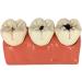 4X Caries Teeth Disassembling Model - Dental Brush & Floss Practice Tool for Teaching & Learning | International Shipping Available - Buy Online on GoSupps.com