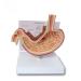 Educational Model Simulated Human Stomach Anatomy Model Diseased Stomach Model Stomach Disease Demonstration Model Pathological Stomach Model Medical Models