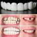 Brigtviee Instant Teeth Veneers 2 Pairs Clipin Veneers False Teeth for Upper and Lower Jaw Dentures Clickon Veneers for Men and Women Temporary Denture Veneers - Buy Online on GoSupps.com