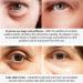 Wow-IT Instant Under Eye Cream - Reduce Eye Bags & Puffiness | Anti-Wrinkle Treatment (3PCS) - Fast International Shipping - Buy Online on GoSupps.com