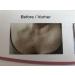 Anti-Wrinkle Silicone D collet Pads - 2 Pack Self-Adhesive Heart Shape for Youthful Skin Appearance - Buy Online on GoSupps.com