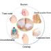 Pedimend Gel Toe Separators & Metatarsal Pads - 2 Pairs | Bunion Corrector & Toe Straightener for Overlapping Toes | Hallux Valgus Relief & Forefoot Pain | 1-Hole Design - Buy Online on GoSupps.com