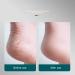 dijiusidy Foot Rasp File Universal Simple Personal Care Pedicure Accessory Stainless Steel Callus Remover Dead Skin Removers Green - Buy Online on GoSupps.com