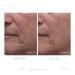Dr. Denese Collagen Firming Peel Off Mask | Anti-Aging AHA Mask | 4 FL oz for Tightening Skin - Buy Online on GoSupps.com