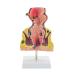 Human Anorectal Pathology Model Hemorrhoid Lesion Model Proctology Hemorrhoid Anal Fistula Lesion Model for Medical Teaching/Education Supplies