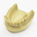 Fhuili Teeth Implant Model - Realistic Dental Simulation for Practice & Education | Lower Half Teeth Demonstration Model - Buy Online on GoSupps.com