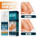 Kelo-cote Scar Gel 15g-2 Pack | Advanced Formula for Surgical, Stretch Marks, C-section, Cosmetic Surgery, Burn & Children's Scars | Softens, Flattens, Eliminates Redness - Buy Online on GoSupps.com