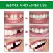 Tooth Filling Repair Kit with Tweezers Temporary Tooth Filling Moldable Tooth Repair Kit False Teeth Repair Beads Tooth Repair Granules Missing Tooth Replacement Kit Filling Kit for Teeth 30ml*2 - Buy Online on GoSupps.com