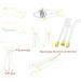 Ofone Contact Lens Remover Tool - Soft Lens Applicator with Tweezers & Case | Portable Contact Inserter & Remover - Travel Friendly (Yellow - Buy Online on GoSupps.com