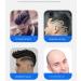 High-Quality Rechargeable Electric Hair Clipper for Men - Bald Hair Clipper with LCD Display | International Shipping Available - Buy Online on GoSupps.com