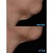 N.E.C.K Control: Neck Lifting Firming & Retracting Cream - Best Anti-Aging Solution for a Youthful Neck | Shop Now Internationally - Buy Online on GoSupps.com