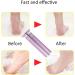 Adjustable Speed Electric Foot Sharpener 1200 RPM Dead Skin Remover with 60 Sandpaper Discs - Buy Online on GoSupps.com