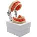ZCBYBT Dental Preparation Model - 28 Replaceable Oral Practice Teeth & Soft Gums | International Shipping Available - Buy Online on GoSupps.com