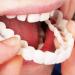 Iksvmsi Protheses Fake Teeth - 2 Pairs of Temporary False Teeth Veneers for Tooth Defects | International Shipping - Buy Online on GoSupps.com