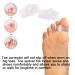 Buy 10 Pieces Bunion Corrector & Silicone Toe Separators - Big Toe Spacer for Overlapping Toes | International Shipping Available - Buy Online on GoSupps.com