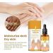 (SUMMER MUST) Best NigriCare Therapy Drops TAIMEI 2024 New Acanthosis Nigricans Therapy Oil Dark Spot Corrector Oil Brightens Joint Complexion for Neck Hands Elbows (2pc) - Buy Online on GoSupps.com