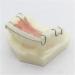 Fhuili Dental Teeth Model for Orthodontics Training - KFO Retainer Study & Teaching Simulation - Buy Online on GoSupps.com