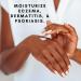True Moringa Shea & Moringa Balm | Scar & Stretch Mark Repair | Intensive Hydrating Cream for Dry & Sensitive Skin | Unscented | 2oz - Shop Now - Buy Online on GoSupps.com