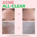 ATOMU Mildly Alkaline Oily Acne Sebum Removal Deep Cleansing ACLIS Foam Cleanser - 4.05 fl.oz | International Shipping Available - Buy Online on GoSupps.com