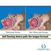 Organic Deal Anti Snore Tongue Retainer - Sleep Aid to Stop Snoring - Effective Snore Stopper Mouth Guard for Women & Men - Buy Online on GoSupps.com