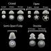 Siemens 8mm Open Click Domes for RIC Hearing Aids - Buy Online on GoSupps.com