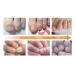 Maximum Strength Nail Fungus Repair Treatment - Natural Formula for Toenail and Fingernail Repair - Buy Online on GoSupps.com