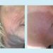 Lactic 50% Gel Peel - Chemical Exfoliant for Face Remove Breakout Scars Strength Level 2 1 oz - Perfect Image - Buy Online on GoSupps.com