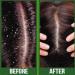 Difeel Premium Castor Plus Tea Tree Hair Oil - Pro-Growth & Scalp Care 2.5 oz - Buy Online on GoSupps.com