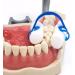 20 Pcs/Bag Cotton Roll Holder Clip Disposable Blue Clip for Dental Dentist Clinic Orthodontic Plastic Compact Clip - Buy Online on GoSupps.com