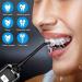 Portable Cordless Water Flosser - Waterproof Dental Oral Irrigator for Effective Teeth Cleaning | Space-Saving Design | International Shipping Available - Buy Online on GoSupps.com