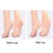 Pumice Stone Pedicure Tools Hard Skin Callus Remover for Feet and Hands - Foot File Exfoliation to Remove Dead Skin and Callusess (Blue) TARSHYRY94p08mqowf-11 - Buy Online on GoSupps.com