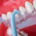 10pcs Aligner Remove Tool Invisible Removable Braces Retainer Aligner Braces Tooth Hook (Random Color) - Buy Online on GoSupps.com