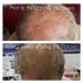 Hair Growth Conditioner - Stimulating Formula for Hair Loss Treatment | Redensyl vs Minoxidil | 250ml - Buy Online on GoSupps.com