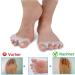 XinLace Bunion Corrector Gel Toe Separators - Toe Spacers for Hammer Toe Treatment and Pain Relief - Buy Online on GoSupps.com