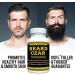 The Beard Czar- Phytoceramides- Promotes Healthy Hair & Smooth Skin- Supports Collagen Production- Helps Maintain Healthy Skin Hydration- 30 Capsules - Buy Online on GoSupps.com