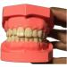 Ernzi Removable Dentures Model - Ideal Typodont for Dental Practice & Study Lessons - Buy Online on GoSupps.com