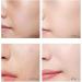 |Most Gifted| 2024 New Korean Protein Thread Lifting Set - Absorbable Collagen Thread for Face Lift - 2 Soluble Protein Thread and 5 Nano Gold Essence Combination - Buy Online on GoSupps.com