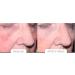 Age Reverse System - Rejuvenate Your Skin & Reverse Aging | Shop Internationally - Buy Online on GoSupps.com