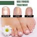 Antifungal Nail Treatment for Damaged Nails - Toe Care Solution for Renewing Discolored Feet - Buy Online on GoSupps.com