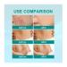 Advanced Scar Removal Spray for Surgical, Acne Scars & Stretch Marks - Skin Care (3pcs) - Buy Online on GoSupps.com